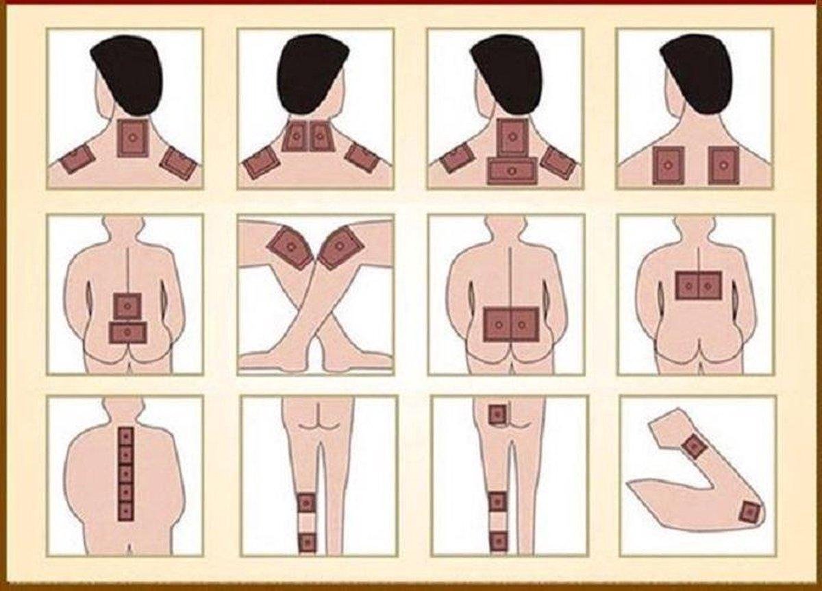 Tijgerbalsem Pleisters 32-Pack