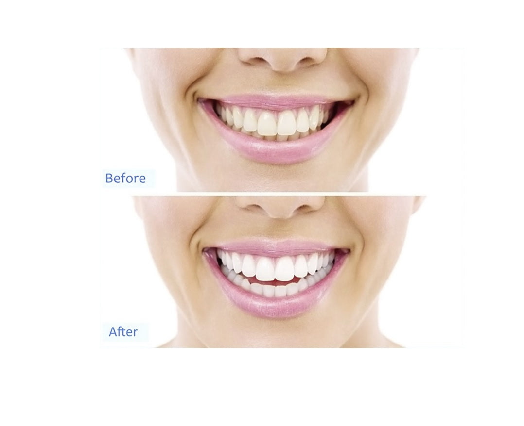 MeditorPlus 20 min White