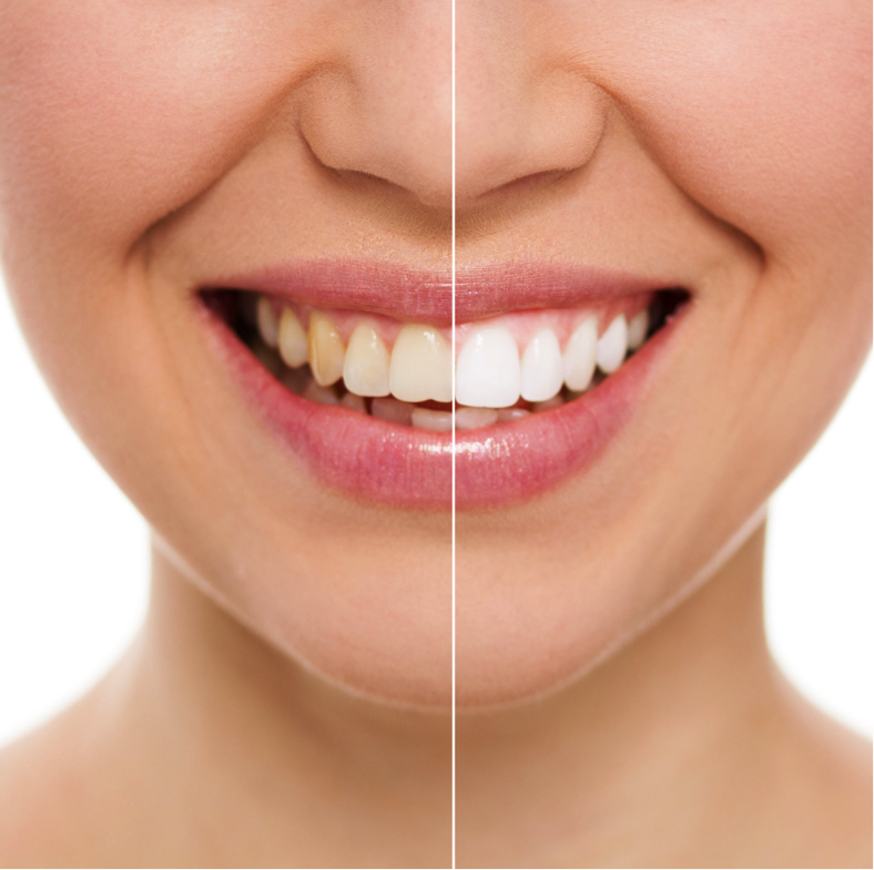 MeditorPlus 20 min White