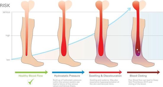 MeditorPlus Therapeutic Compression Socks 3 Pair White - S/M