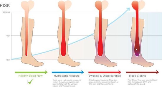 MeditorPlus Therapeutische Compressiesokken 3 paar Blauw - L/XL