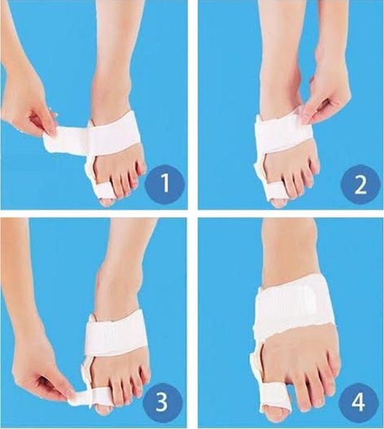 Toe Corrector - Hallux Valgus - MeditorPlus